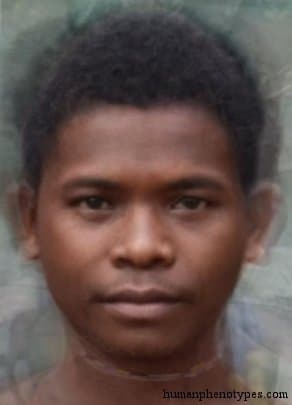 Aetid phenotype average face