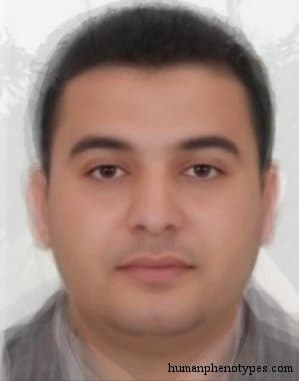 African Alpinoid phenotype average face