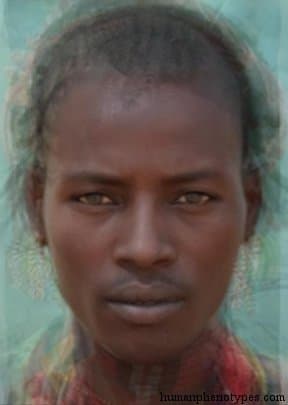 Omotic phenotype average face