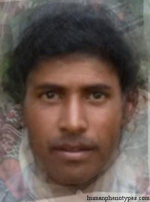 Toda phenotype average face